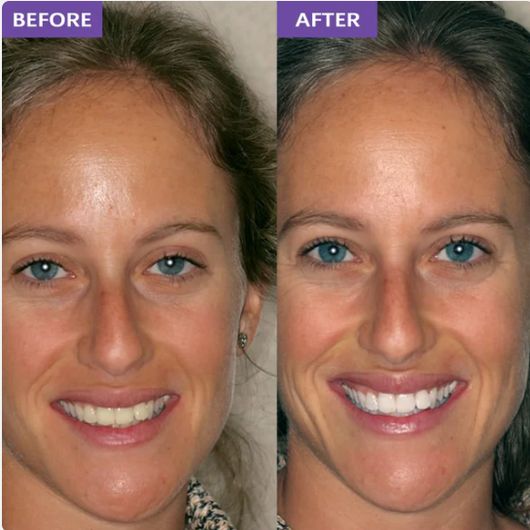 Claydon Co. Whitening Strips