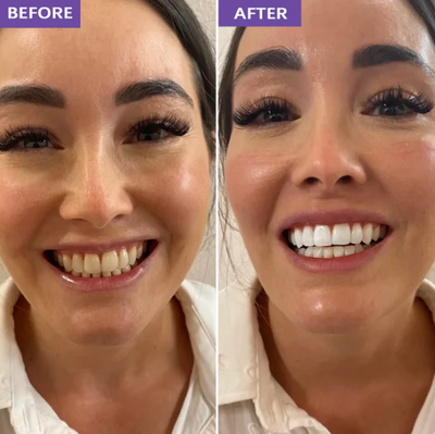 Claydon Co. Whitening Strips